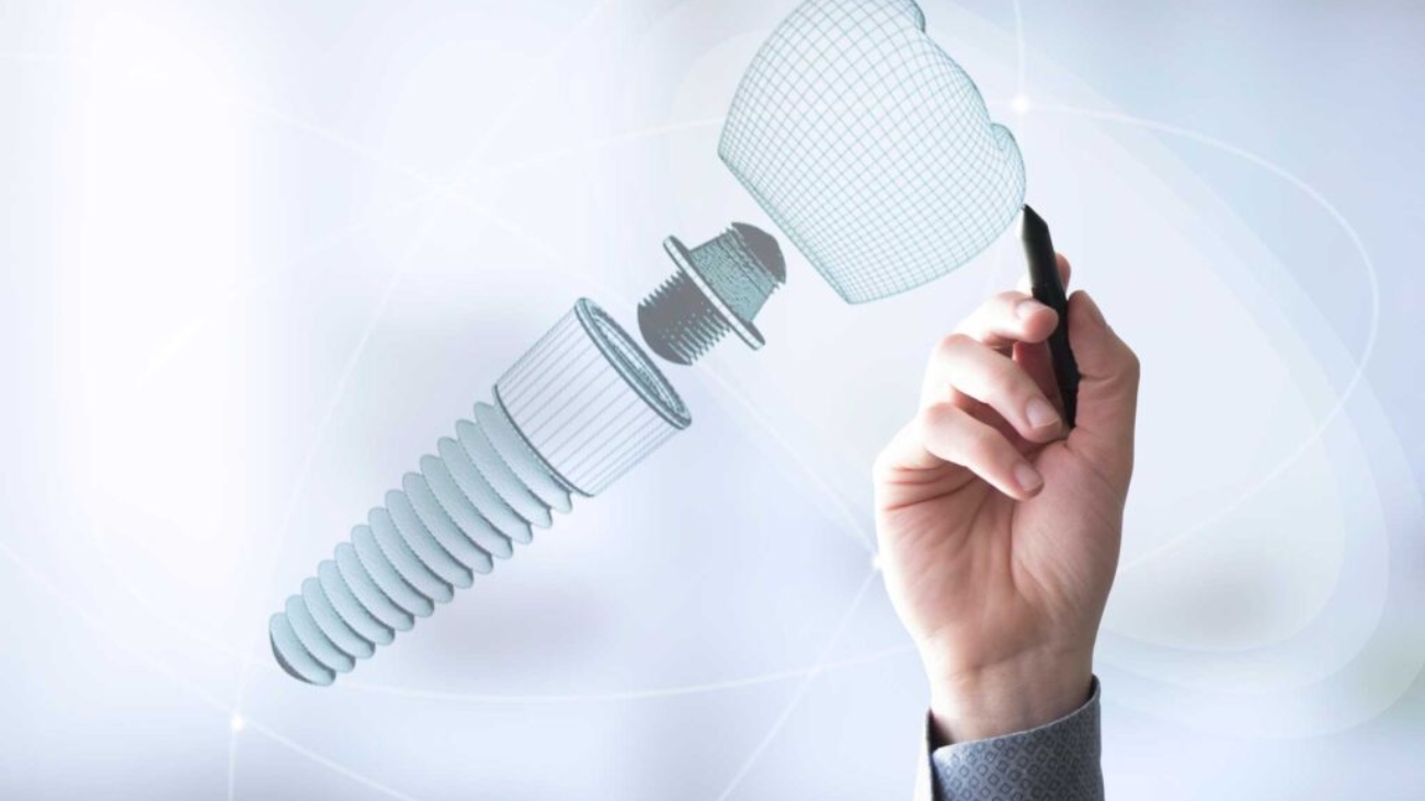 Coronas-de-Porcelana-2-1024x682