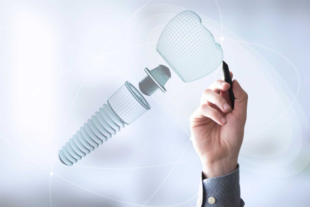 Coronas-de-Porcelana-2-1024x682