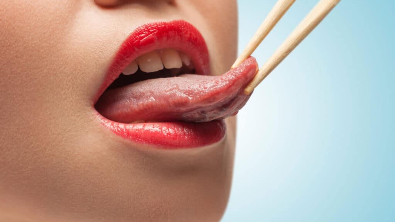 Frenectomía-4-1024x682