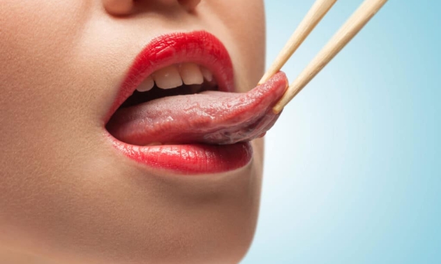 Clinica Dental 8 Frenectomía-4-1024x682