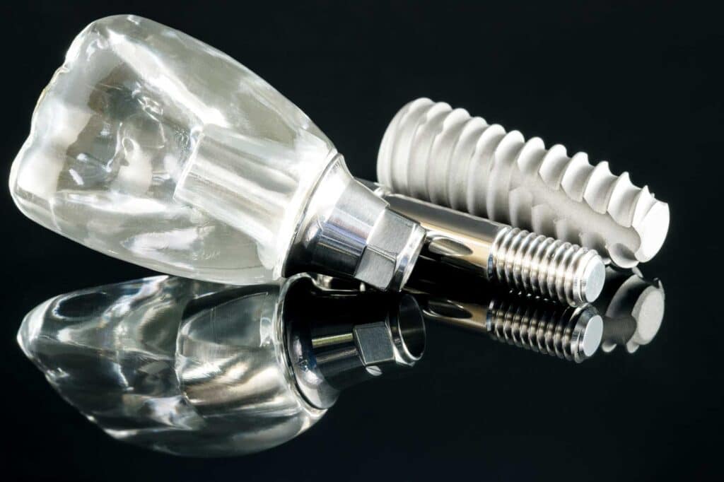 Implantes-Dentales-2-1024x682