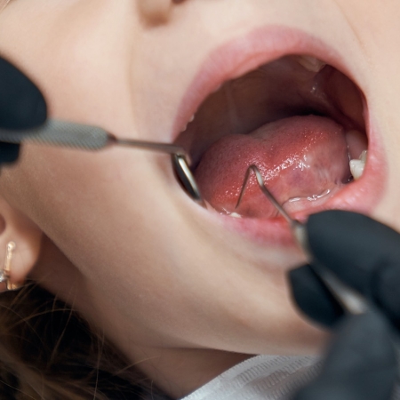 Portrait of pretty bold female child sitting in dental chair with open mouth while professional doctor in rubber gloves carefully examining condition of teeth. Concept of dentistry