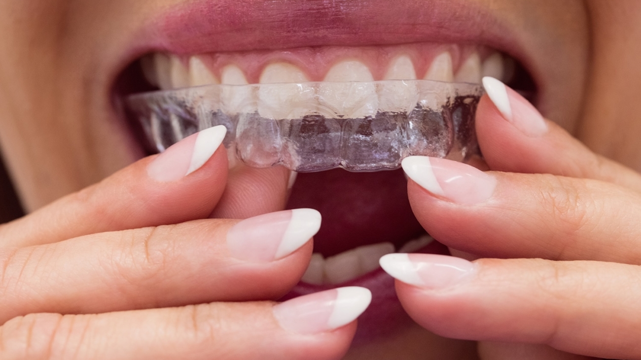 Close-up of female patient wearing braces in dental clinic