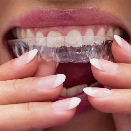 Close-up of female patient wearing braces in dental clinic