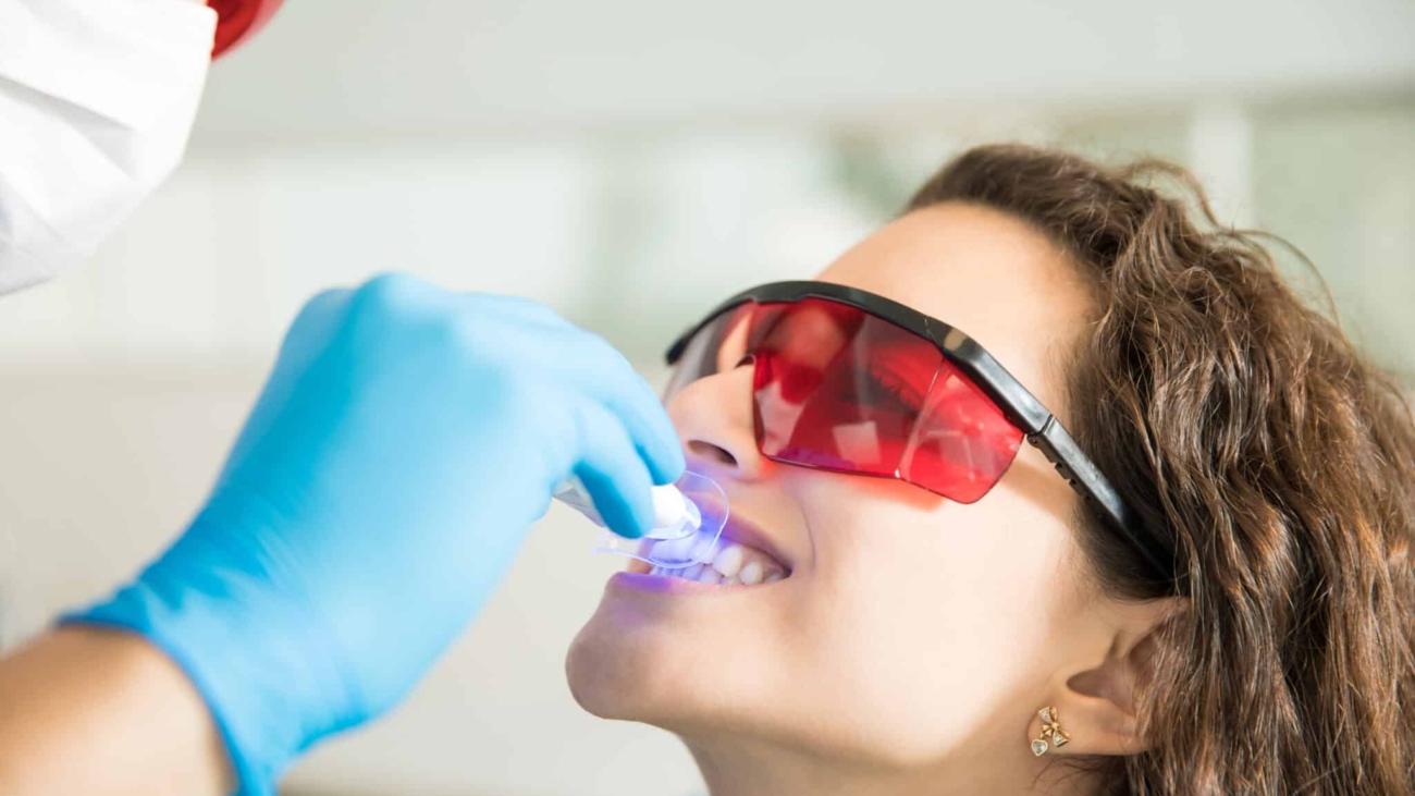 Closeup of young woman having her teeth whitened with ultraviolet light in a dental clinic