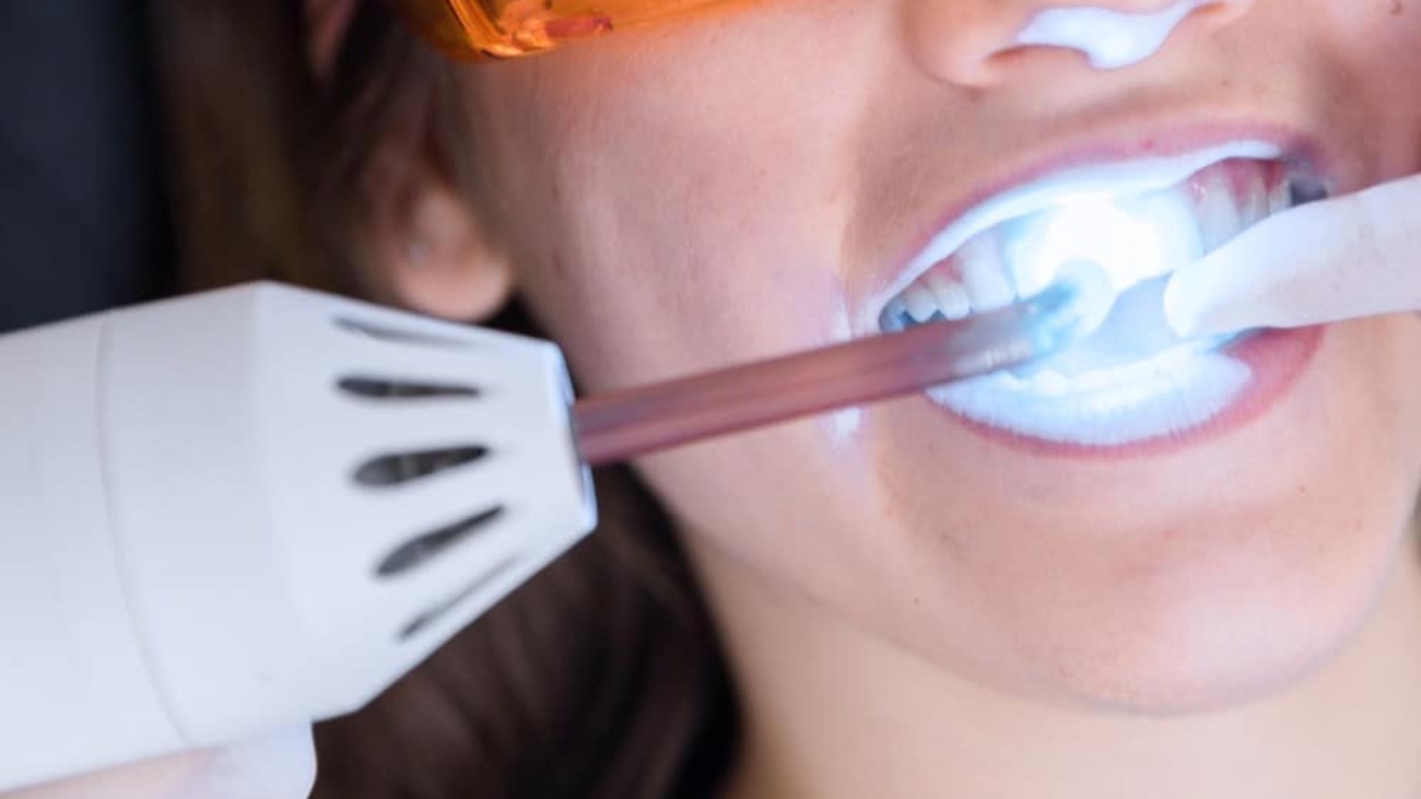 blanqueamientodental