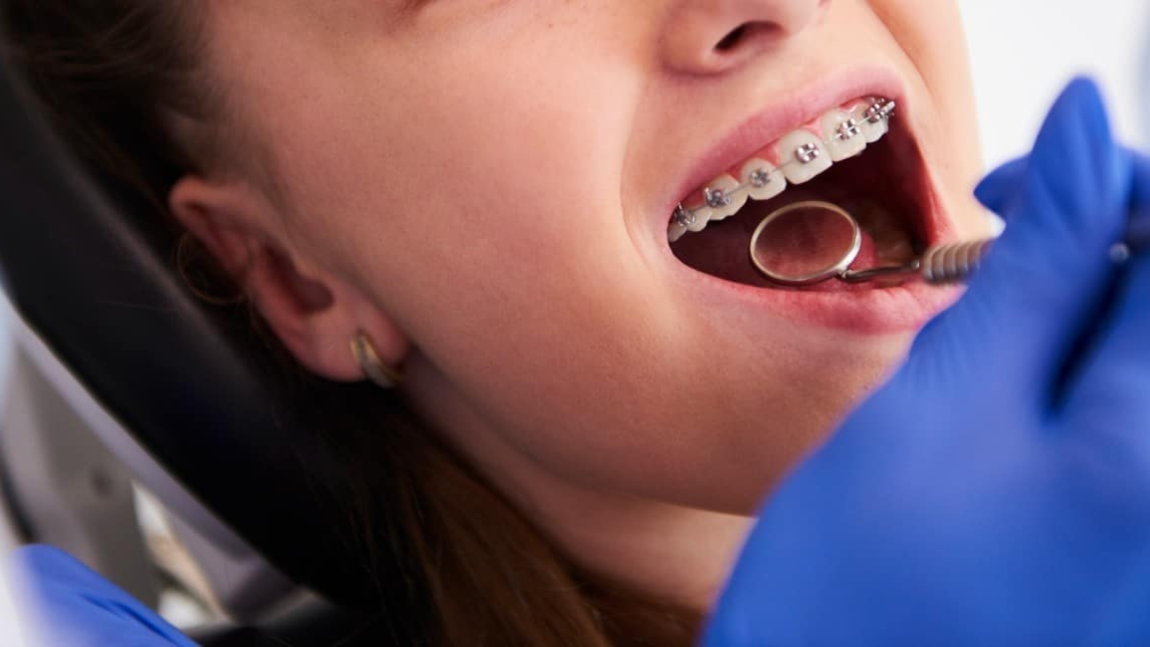 ortodonciainfantil