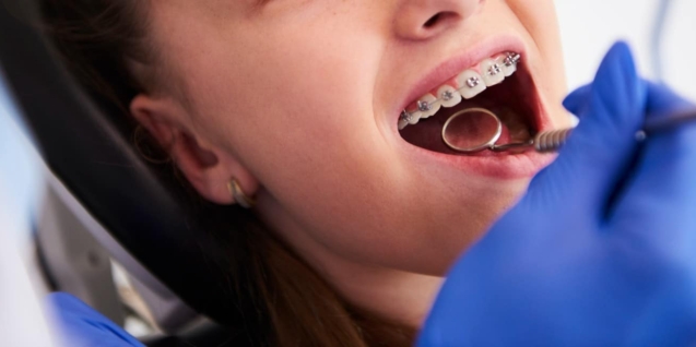 Blog 20 ortodonciainfantil