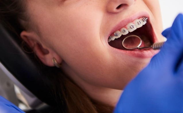 Blog 13 ortodonciainfantil