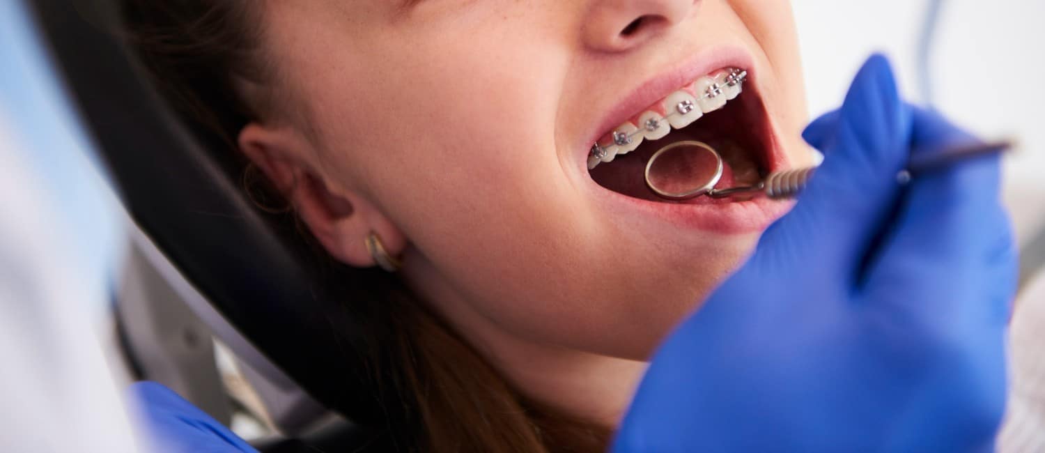 ortodonciainfantil