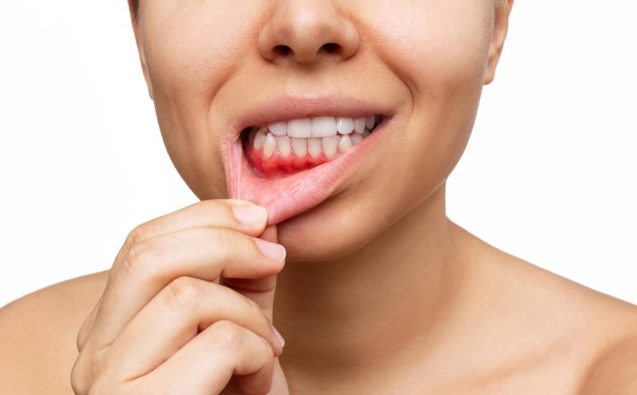 Blog 16 sangrado encias