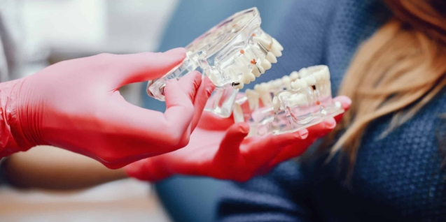 Blog 4 Plastic jaw in the dentist's office. The doctor holds in the hands of dental implants.