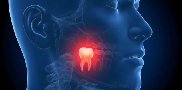 Blog 13 severe-toothache