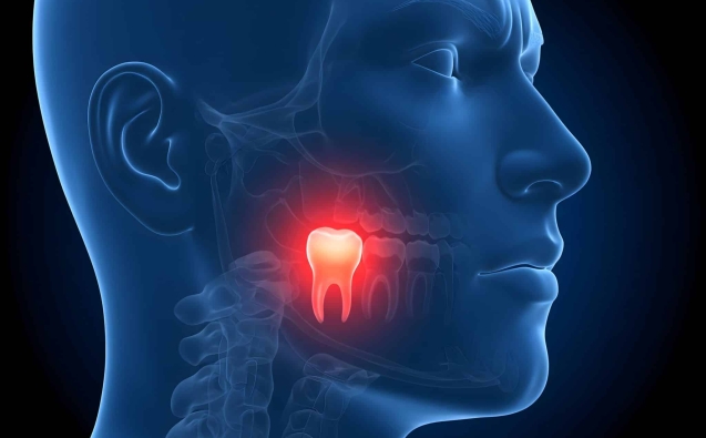 Clinica Dental 8 severe-toothache