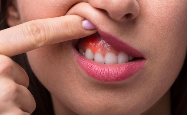 Clinica Dental 5 sensibilidad