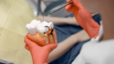 endodoncia