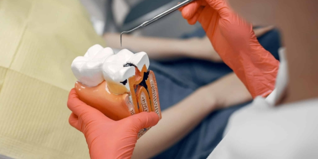 endodoncia