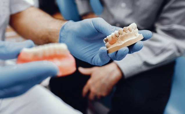Clinica Dental 72 implante dental para reponer un diente perdido y frenar la pérdida de hueso maxilar