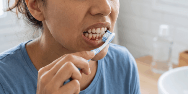 persona con encías que sangran al cepillarse los dientes frente al espejo