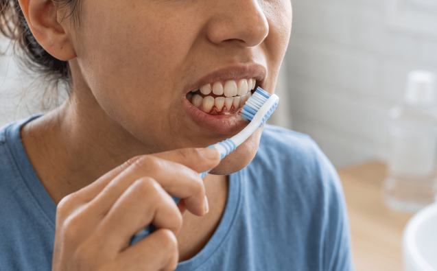 Clinica Dental 72 sangran tus encias al cepillarte